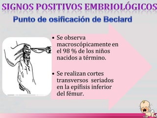 • Se observa
macroscópicamente en
el 98 % de los niños
nacidos a término.
• Se realizan cortes
transversos seriados
en la epífisis inferior
del fémur.
 
