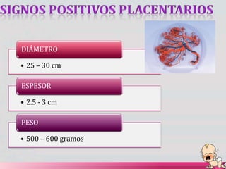 DIÁMETRO
• 25 – 30 cm
ESPESOR
• 2.5 - 3 cm
PESO
• 500 – 600 gramos
 