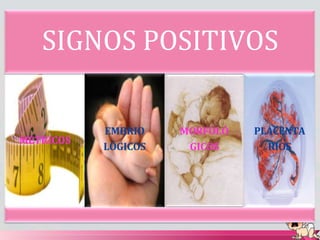 SIGNOS POSITIVOS
MÉTRICOS
EMBRIO
LÓGICOS
MORFOLÓ
GICOS
PLACENTA
RIOS
 