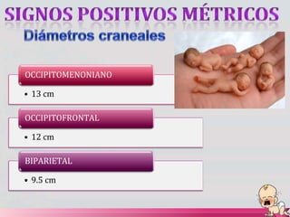 OCCIPITOMENONIANO
• 13 cm
OCCIPITOFRONTAL
• 12 cm
BIPARIETAL
• 9.5 cm
 