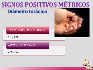 TRANSVERSO O BIACROMIAL
• 12 cm
ANTEROPOSTERIOR
• 9.5 cm
 