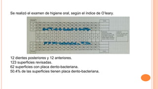 Se realizó el examen de higiene oral, según el índice de O’leary.
12 dientes posteriores y 12 anteriores.
123 superficies revisadas.
62 superficies con placa dento-bacteriana.
50.4% de las superficies tienen placa dento-bacteriana.
 