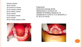 Dientes cariados:
26 por oclusal.
35 curación en oclusal.
55 por mesial y oclusal.
64 por distal y oclusal.
65 por oclusal.
74 por distal y oclusal.
85 por oclusal.
84 por mesial, oclusal y distal.
Tratamiento:
-Extracción indicada del 85
-Restauración o corona en 54
-Sellador de fosetas y fisuras en 14
-Ortodoncia en 14,53,12,11,21,22,63,64 y 4
73, 32,31,41,42,83.
 