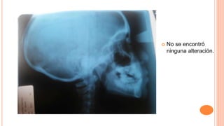  No se encontró
ninguna alteración.
 