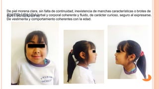De piel morena clara, sin falta de continuidad, inexistencia de manchas características o brotes de
algún tipo, lenguaje verbal y corporal coherente y fluido, de carácter curioso, seguro al expresarse.
De vestimenta y comportamiento coherentes con la edad.
EXTRABUCAL
 