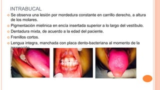 INTRABUCAL
 Se observa una lesión por mordedura constante en carrillo derecho, a altura
de los molares.
 Pigmentación mielinica en encía insertada superior a lo largo del vestíbulo.
 Dentadura mixta, de acuerdo a la edad del paciente.
 Frenillos cortos.
 Lengua integra, manchada con placa dento-bacteriana al momento de la
inspección.
 