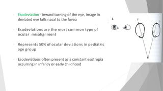 Infantile esotropia | PPTX