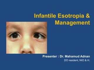 Presenter : Dr. Mahamud Adnan
DO resident, NIO & H.
Infantile Esotropia &
Management
 