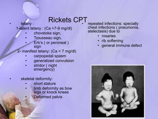 Infantile rickets for pedo | PPT