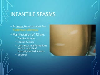 INFANTILE SPASMS
• Pt must be evaluated for
Tuberous sclerosis
• Manifestation of TS are:
• Cardiac tumors
• kidney tumors
• cutaneous malformations
such as ash-leaf
hypopigmented lesions
• seizures
 