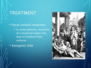 TREATMENT
• Focal cortical resection
• In some patients, resection
of a localized region can
lead to freedom from
seizures.
• Ketogenic Diet
 