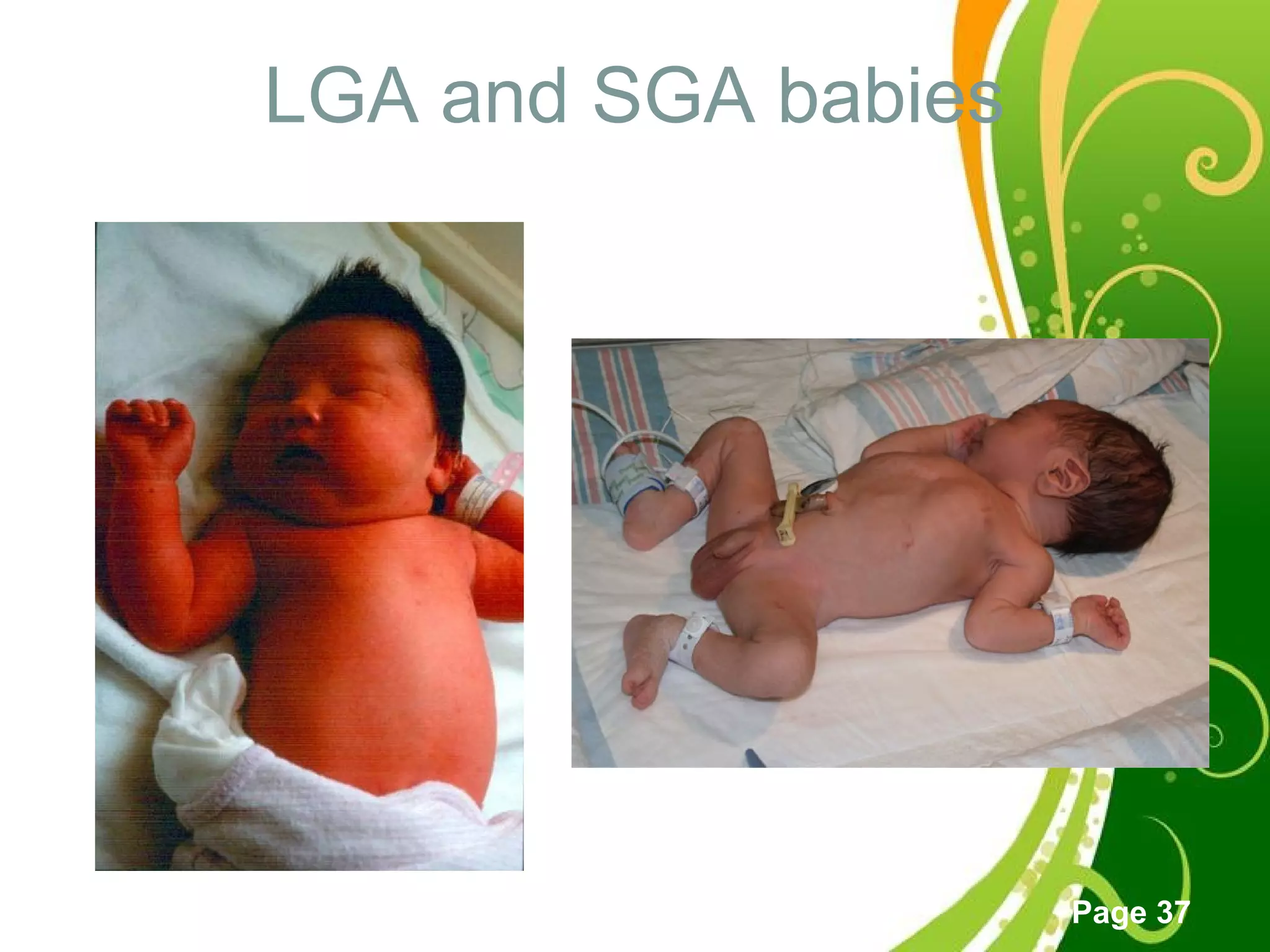 Click here to download this powerpoint template : Green Floral Free Powerpoint Template
For more : Powerpoint Template Presentations
Page 37
LGA and SGA babies
 