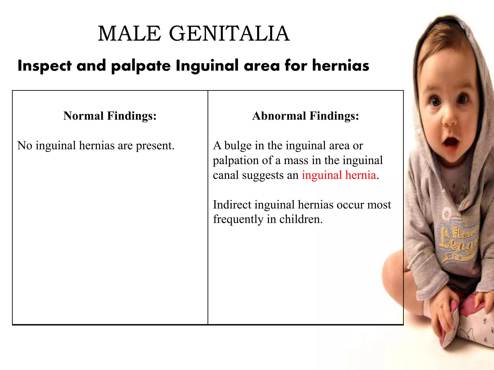 MALE GENITALIA
Normal Findings:
No inguinal hernias are present.
Abnormal Findings:
A bulge in the inguinal area or
palpation of a mass in the inguinal
canal suggests an inguinal hernia.
Indirect inguinal hernias occur most
frequently in children.
Inspect and palpate Inguinal area for hernias
 