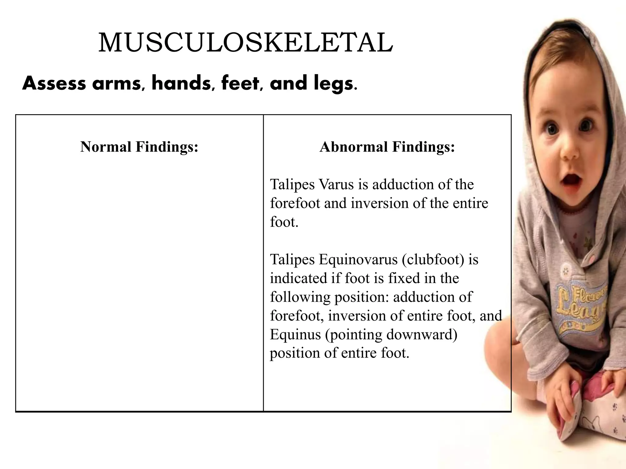 MUSCULOSKELETAL
Normal Findings: Abnormal Findings:
Talipes Varus is adduction of the
forefoot and inversion of the entire
foot.
Talipes Equinovarus (clubfoot) is
indicated if foot is fixed in the
following position: adduction of
forefoot, inversion of entire foot, and
Equinus (pointing downward)
position of entire foot.
Assess arms, hands, feet, and legs.
 