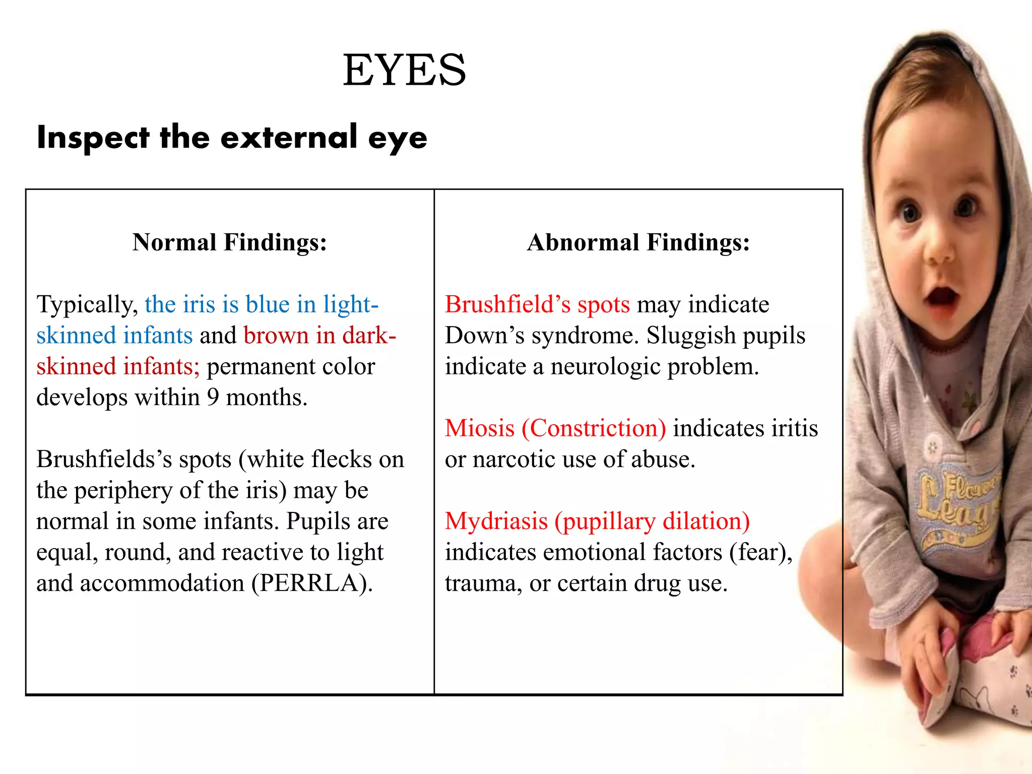 EYES
Normal Findings:
Typically, the iris is blue in light-
skinned infants and brown in dark-
skinned infants; permanent color
develops within 9 months.
Brushfields’s spots (white flecks on
the periphery of the iris) may be
normal in some infants. Pupils are
equal, round, and reactive to light
and accommodation (PERRLA).
Abnormal Findings:
Brushfield’s spots may indicate
Down’s syndrome. Sluggish pupils
indicate a neurologic problem.
Miosis (Constriction) indicates iritis
or narcotic use of abuse.
Mydriasis (pupillary dilation)
indicates emotional factors (fear),
trauma, or certain drug use.
Inspect the external eye
 