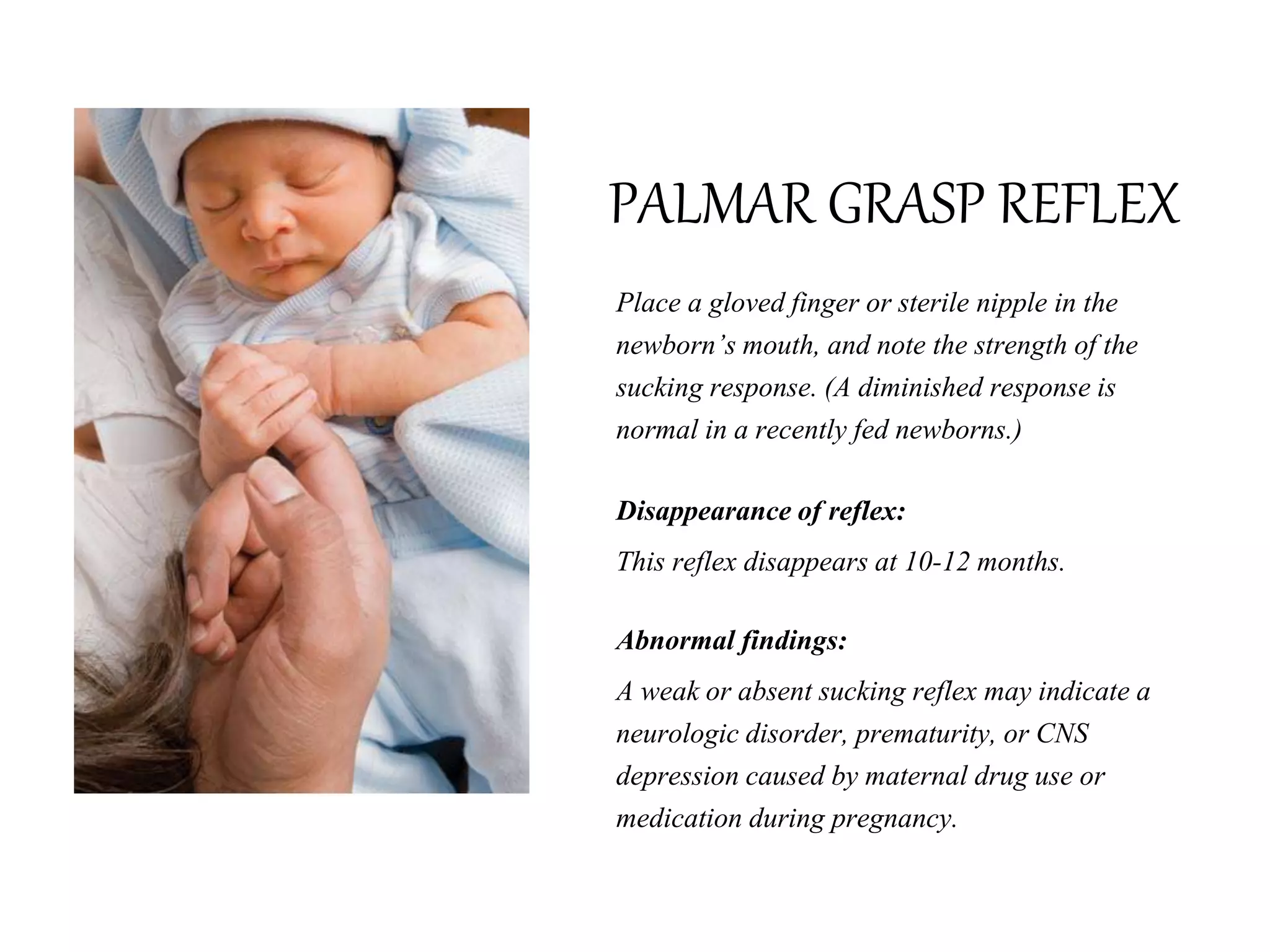 PALMAR GRASP REFLEX
Place a gloved finger or sterile nipple in the
newborn’s mouth, and note the strength of the
sucking response. (A diminished response is
normal in a recently fed newborns.)
Disappearance of reflex:
This reflex disappears at 10-12 months.
Abnormal findings:
A weak or absent sucking reflex may indicate a
neurologic disorder, prematurity, or CNS
depression caused by maternal drug use or
medication during pregnancy.
 