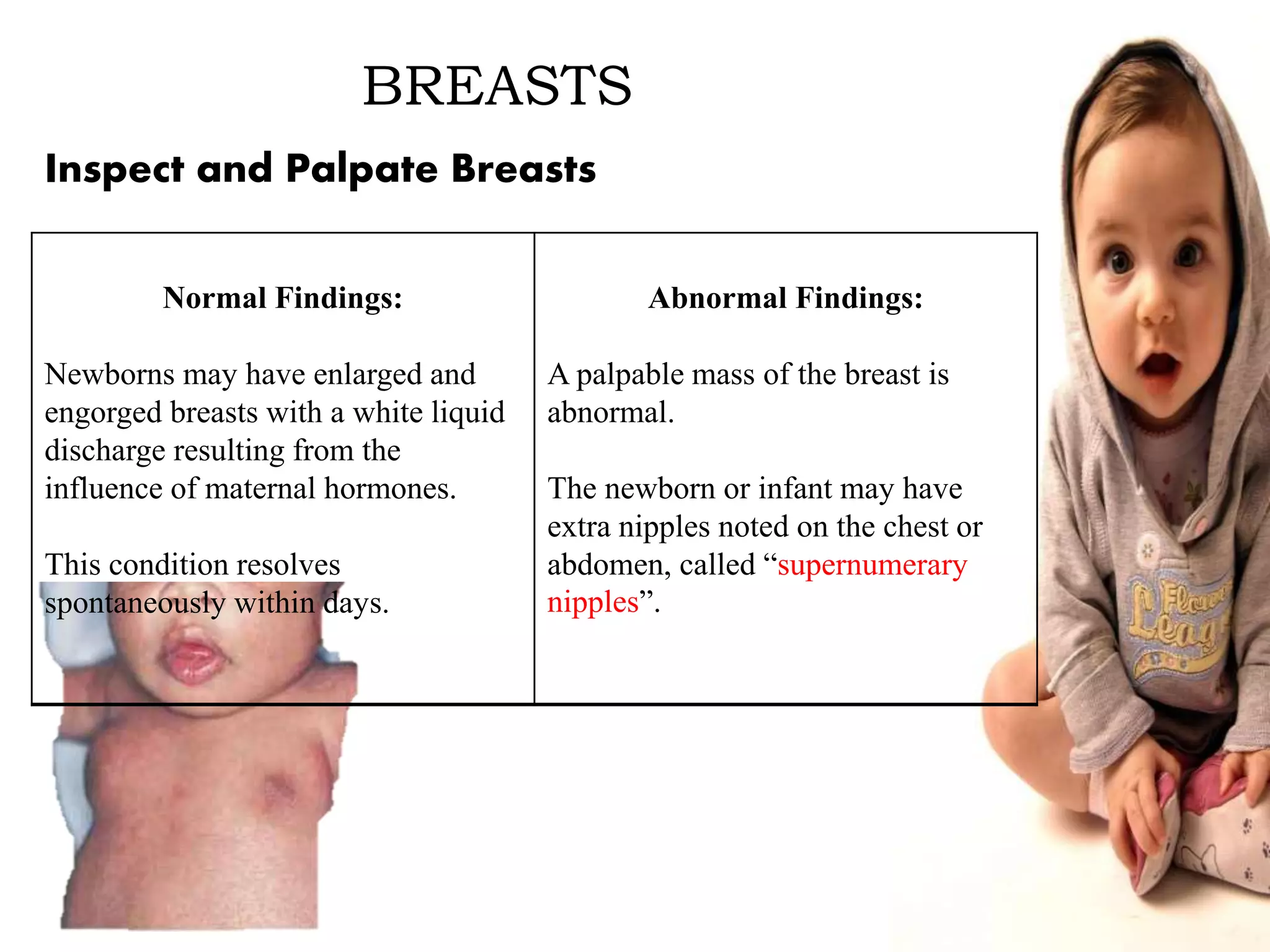 Infant Physical Assessment