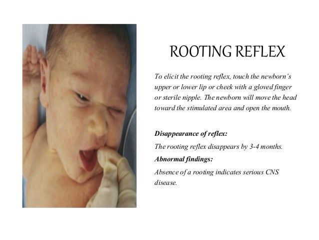 when does the rooting reflex disappear – newborn rooting reflex – ZRJHVU
