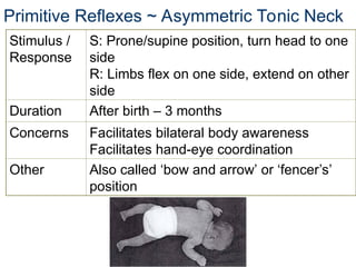 Sandifer Position infant reflexes.ppt neuro rehabilitation | PPT