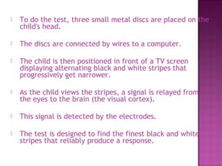    To do the test, three small metal discs are placed on the
    child's head.

   The discs are connected by wires to a computer.

   The child is then positioned in front of a TV screen
    displaying alternating black and white stripes that
    progressively get narrower.

   As the child views the stripes, a signal is relayed from
    the eyes to the brain (the visual cortex).

   This signal is detected by the electrodes.

   The test is designed to find the finest black and white
    stripes that reliably produce a response.
 