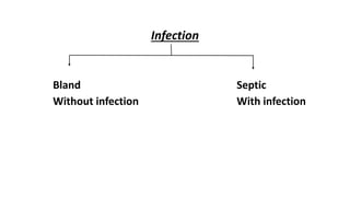 Infection
Bland Septic
Without infection With infection
 