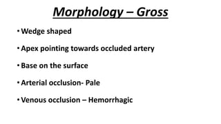 Morphology – Gross
• Wedge shaped
• Apex pointing towards occluded artery
• Base on the surface
• Arterial occlusion- Pale...