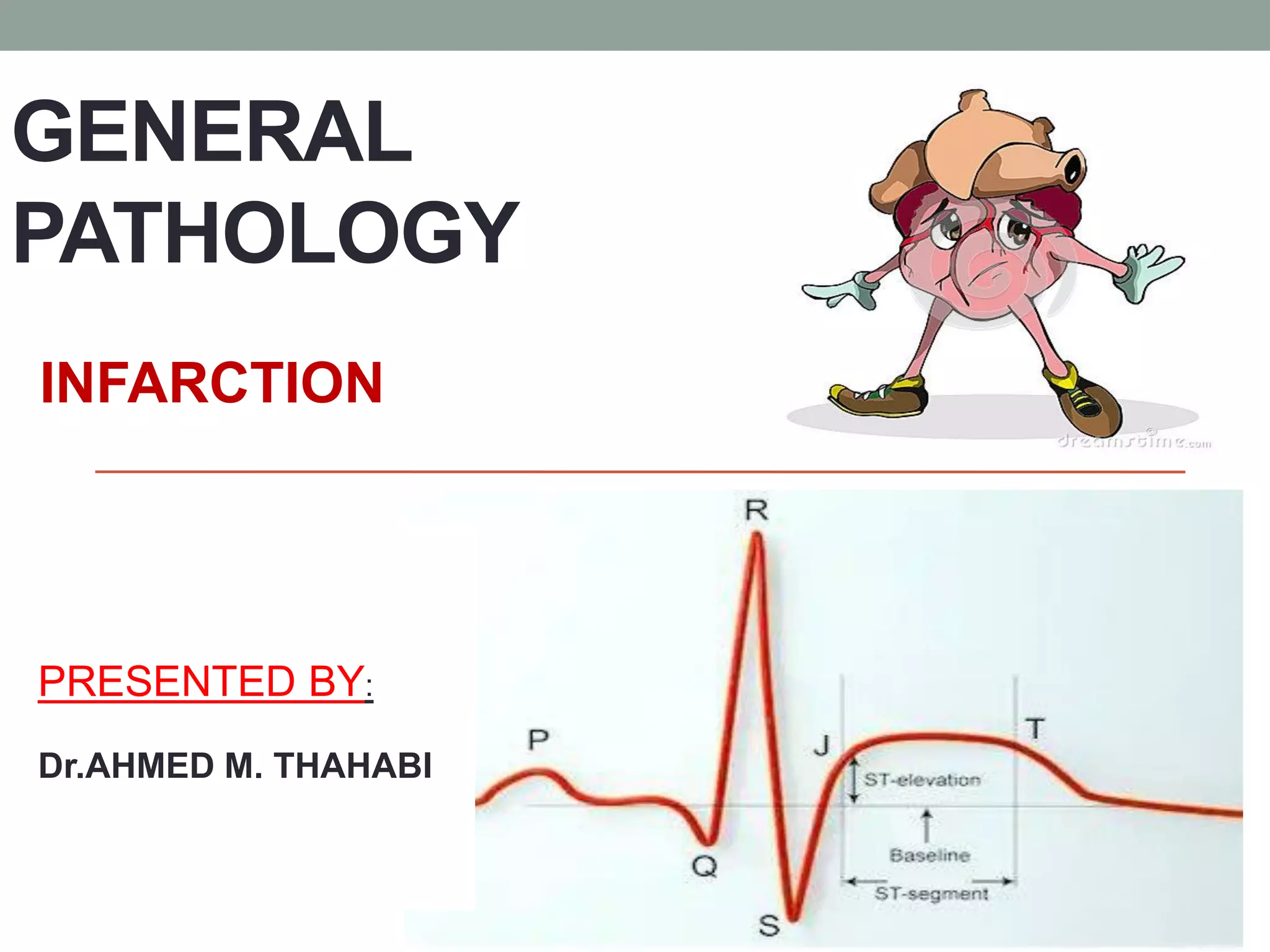 INFARCTION | PDF