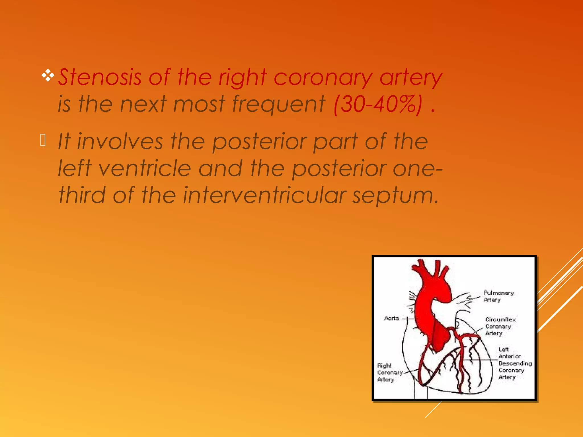 Infarction | PPT | Heart and Cardiovascular Diseases | Diseases and ...