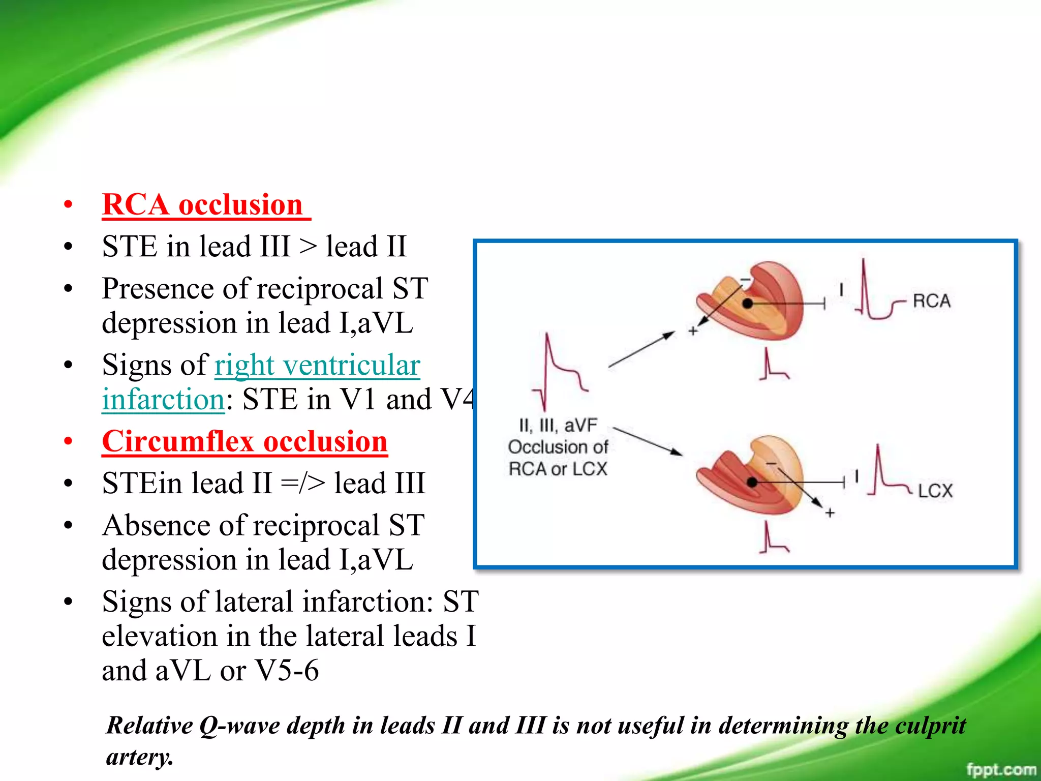 • RCA occlusion
• STE in lead III > lead II
• Presence of reciprocal ST
depression in lead I,aVL
• Signs of right ventricular
infarction: STE in V1 and V4R
• Circumflex occlusion
• STEin lead II =/> lead III
• Absence of reciprocal ST
depression in lead I,aVL
• Signs of lateral infarction: ST
elevation in the lateral leads I
and aVL or V5-6
Relative Q-wave depth in leads II and III is not useful in determining the culprit
artery.
 