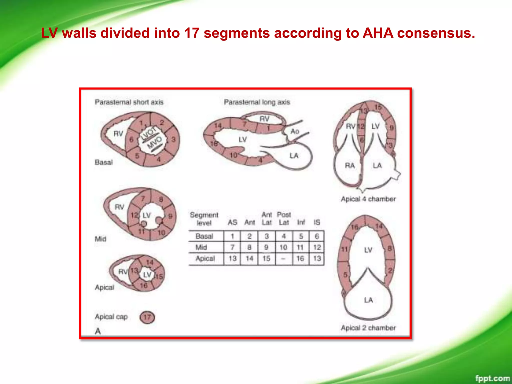 LV walls divided into 17 segments according to AHA consensus.
 