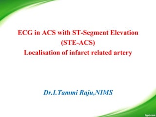 ECG in ACS with ST-Segment Elevation
(STE-ACS)
Localisation of infarct related artery
Dr.I.Tammi Raju,NIMS
 