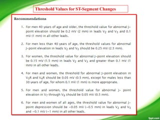 Threshold Values for ST-Segment Changes
 