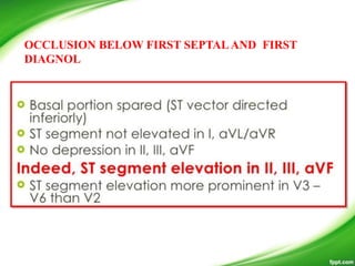 OCCLUSION BELOW FIRST SEPTALAND FIRST
DIAGNOL
 
