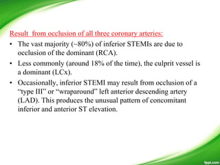Result from occlusion of all three coronary arteries:
• The vast majority (~80%) of inferior STEMIs are due to
occlusion of the dominant (RCA).
• Less commonly (around 18% of the time), the culprit vessel is
a dominant (LCx).
• Occasionally, inferior STEMI may result from occlusion of a
―type III‖ or ―wraparound‖ left anterior descending artery
(LAD). This produces the unusual pattern of concomitant
inferior and anterior ST elevation.
 