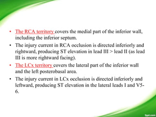 • The RCA territory covers the medial part of the inferior wall,
including the inferior septum.
• The injury current in RCA occlusion is directed inferiorly and
rightward, producing ST elevation in lead III > lead II (as lead
III is more rightward facing).
• The LCx territory covers the lateral part of the inferior wall
and the left posterobasal area.
• The injury current in LCx occlusion is directed inferiorly and
leftward, producing ST elevation in the lateral leads I and V5-
6.
 