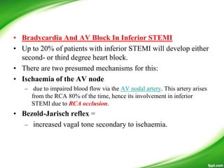 • Bradycardia And AV Block In Inferior STEMI
• Up to 20% of patients with inferior STEMI will develop either
second- or third degree heart block.
• There are two presumed mechanisms for this:
• Ischaemia of the AV node
– due to impaired blood flow via the AV nodal artery. This artery arises
from the RCA 80% of the time, hence its involvement in inferior
STEMI due to RCA occlusion.
• Bezold-Jarisch reflex =
– increased vagal tone secondary to ischaemia.
 
