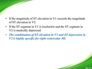 • If the magnitude of ST elevation in V1 exceeds the magnitude
of ST elevation in V2.
• If the ST segment in V1 is isoelectric and the ST segment in
V2 is markedly depressed.
• The combination of ST elevation in V1 and ST depression in
V2 is highly specific for right ventricular MI.
 