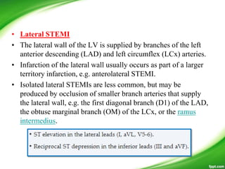 • Lateral STEMI
• The lateral wall of the LV is supplied by branches of the left
anterior descending (LAD) and left circumflex (LCx) arteries.
• Infarction of the lateral wall usually occurs as part of a larger
territory infarction, e.g. anterolateral STEMI.
• Isolated lateral STEMIs are less common, but may be
produced by occlusion of smaller branch arteries that supply
the lateral wall, e.g. the first diagonal branch (D1) of the LAD,
the obtuse marginal branch (OM) of the LCx, or the ramus
intermedius.
 