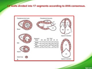 LV walls divided into 17 segments according to AHA consensus.
 