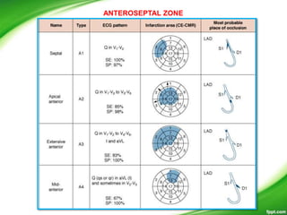 ANTEROSEPTAL ZONE
 