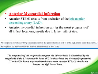 • Anterior Myocardial Infarction
• Anterior STEMI results from occlusion of the left anterior
descending artery (LAD).
• Anterior myocardial infarction carries the worst prognosis of
all infarct locations, mostly due to larger infarct size.
The magnitude of the reciprocal change in the inferior leads is determined by the
magnitude of the ST elevation in I and aVL (as these leads are electrically opposite to
III and aVF), hence may be minimal or absent in anterior STEMIs that do not
involve the high lateral leads.
 