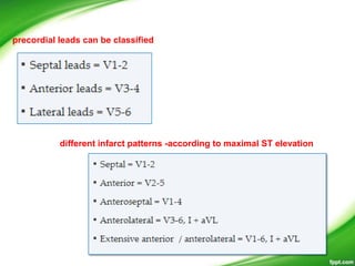 precordial leads can be classified
different infarct patterns -according to maximal ST elevation
 