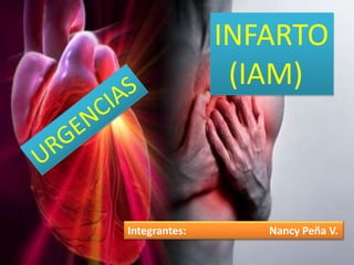 INFARTO
(IAM)
Integrantes: Nancy Peña V.
 
