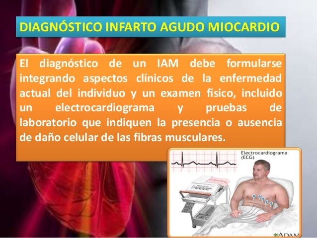 Image result for diagnostico infarto al miocardio
