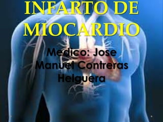 INFARTO DE
MIOCARDIO
Medico: Jose
Manuel Contreras
Helguera
 