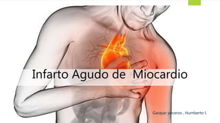 Infarto Agudo de Miocardio
Garayar peceros , Humberto l.
 