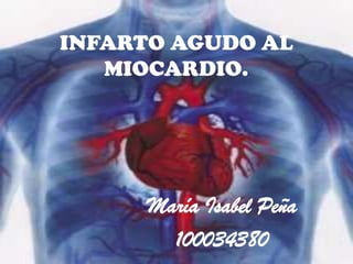 INFARTO AGUDO AL
MIOCARDIO.
María Isabel Peña
100034380
 