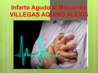 Infarto Agudo al Miocardio
VILLEGAS AQUINO ALEXIS
 