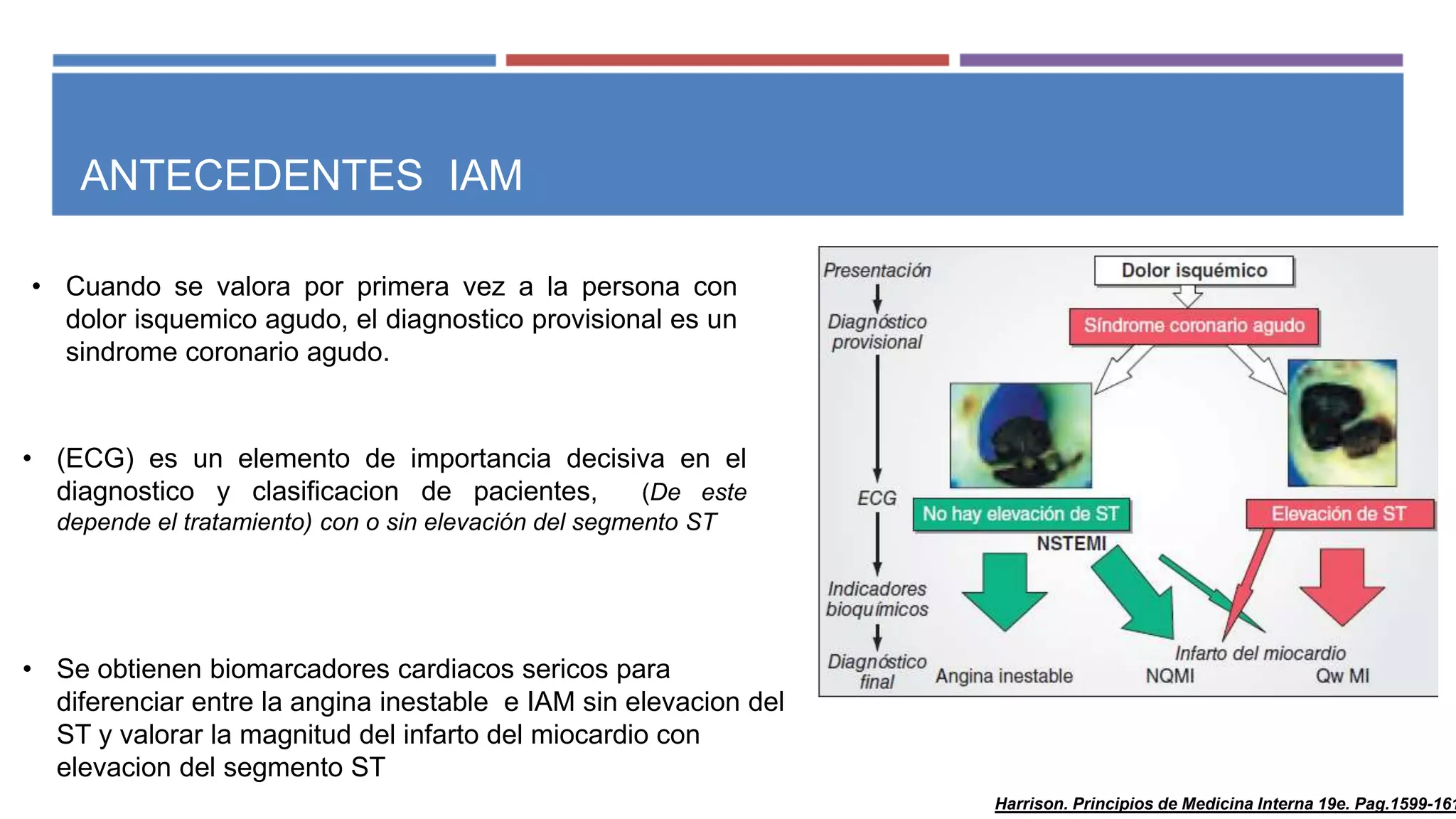 Infarto agudo al miocardio con elevacion del segmento st | PPTX