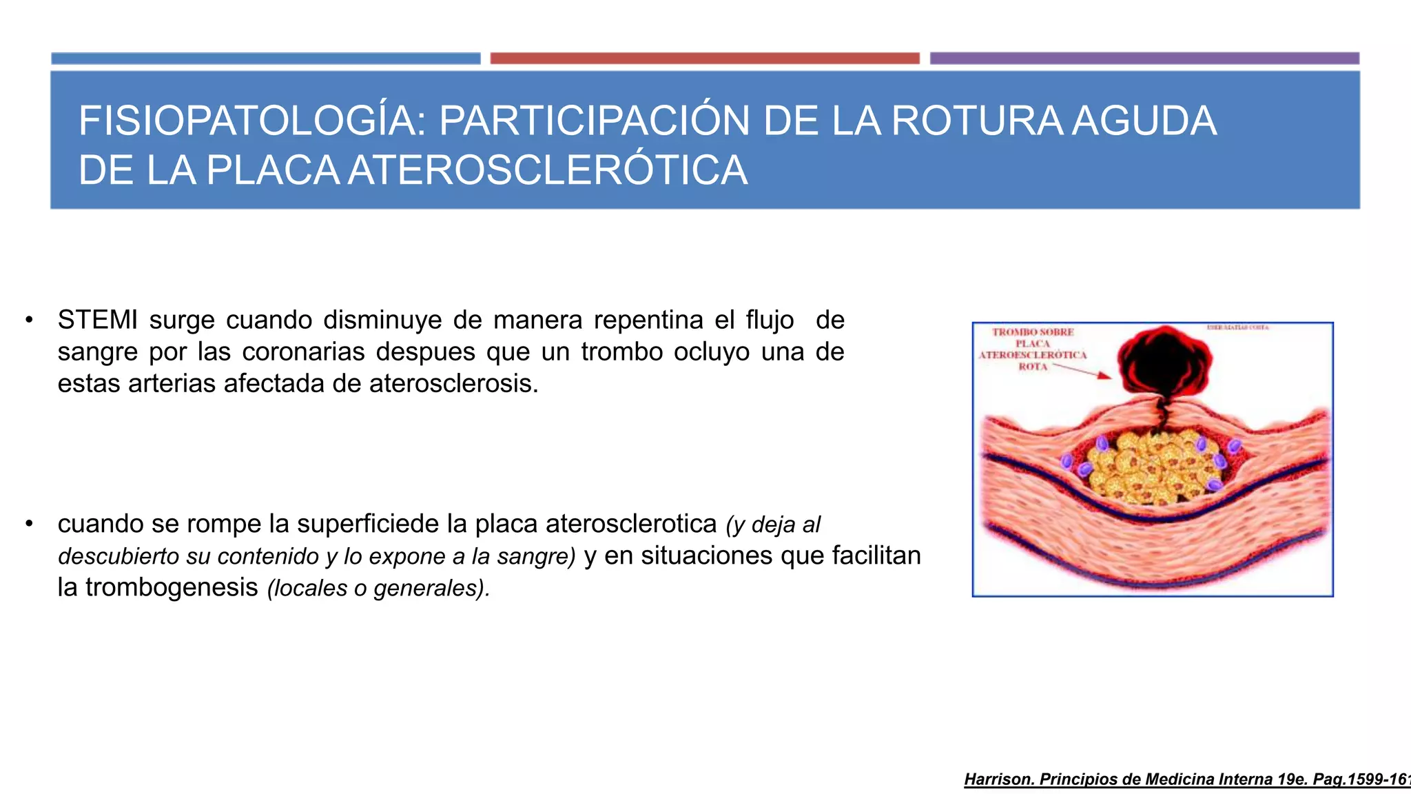 Infarto agudo al miocardio con elevacion del segmento st | PPT